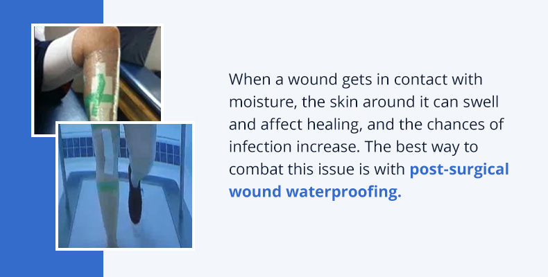 waterproofing post surgical wound