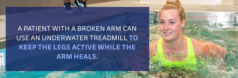 graphic of a female running in a pool with the quote A patient with a broken arm can use an underwater treadmill to keep the legs active while the arm heals